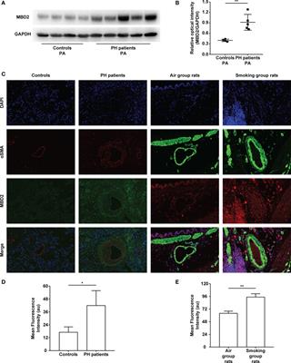 Increased Methyl-CpG-Binding Domain Protein 2 Promotes Cigarette Smoke-Induced Pulmonary Hypertension